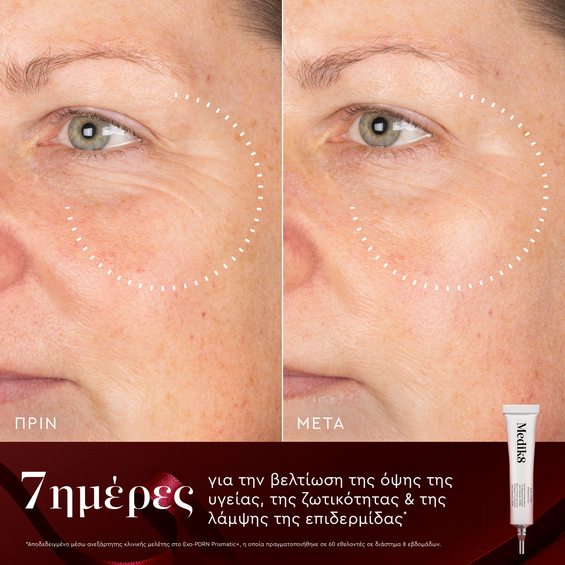 Rejuvenation routine - Image 5